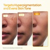 image:imagePLANTIFIQUE Kojic Acid amp Turmeric Soap for Dark Spots amp Hyperpigmentation1 Bar with Case