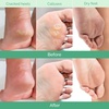 image:imagePLANTIFIQUE Foot Peeling Mask for Men Dermatologically Tested  2 PairsPeach