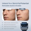 image:imagePLANTIFIQUE Derma Roller for Hair amp Skin  Microneedling Face Roller GreyGrey