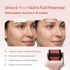 image:imagePLANTIFIQUE Derma Roller for Hair amp Skin  Microneedling Face Roller GreyPink