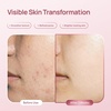 image:imagePLANTIFIQUE Korean Face Serum Niacinamide 10 TXA 4 PhytoPDRN Centella