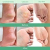 image:imagePLANTIFIQUE Korean Hydrating Foot Mask 2 Pairs amp Foot Peel Mask 4 Pack