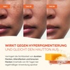 image:imagePLANTIFIQUE Kojic Acid Soap for Hyperpigmentation  Turmeric Soap 2 Bars amp Kojic Acid and Turmeric Cleansing Pads 60
