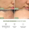 image:imagePLANTIFIQUE Korean Skincare Clay Mask and Korean Glycolic Acid Pads with CICA 60 Pcs