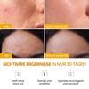 image:imagePLANTIFIQUE Koreanc Turmeric Clay Mask with Vitamin C for Face amp Body  110 g amp Kojic Acid and Turmeric Cleansing Pads for Skin Refresh  60 Exfoliating Facial Pads