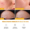 image:imagePLANTIFIQUE Korean Face Mask Collection  Superfood Marine Clay Turmeric amp Vitamin C Clay for Dark Sports and Volcanic amp Dead Sea Mud  Pore Refining Hydrating amp Calming Face Masks  3x110 g