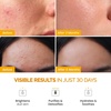 image:imagePLANTIFIQUE Superfood Facial Sheet Mask Variety Box 5 Pack amp Korean Turmeric Clay Mask with Vitamin C for Face amp Body  Targets Dark Spots Refines Pores amp Hydrates 110 g